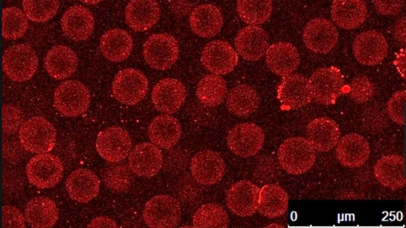 Het suiker-tot-vezel-enzym van de Wyss is ingekapseld in bolvormige nanodeeltjes die het beschermen tijdens voedselproductieprocessen en vervolgens openbreken in de menselijke darm om hun lading vrij te geven. Credits: Wyss Instituut aan de Harvard Universiteit