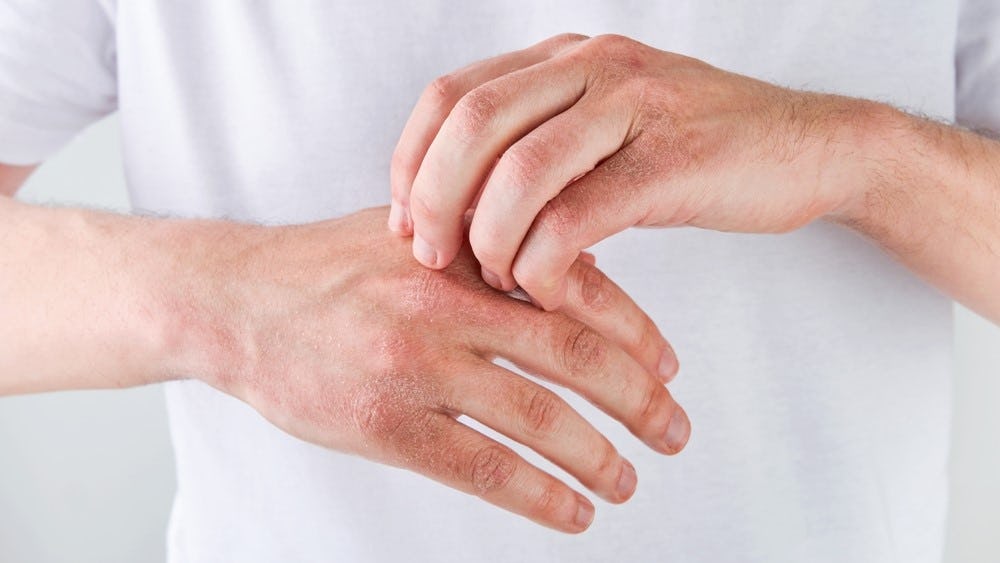 Foto: Shutterstock